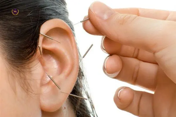 Ảnh: Ù tai dưới góc nhìn y học cổ truyền