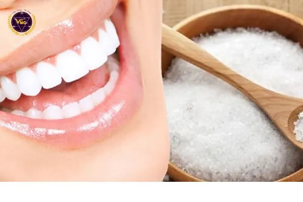 Ảnh: Top 6 nguyên nhân gây vàng răng và cách khắc phục hiệu quả