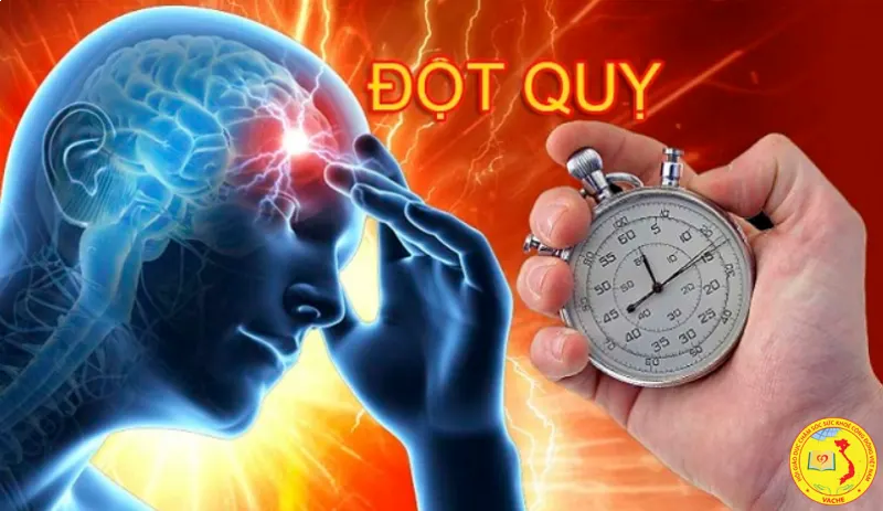 Ảnh: Vì sao đột quỵ đang trẻ hóa – và làm gì để nhận biết, phòng tránh một cách khoa học?